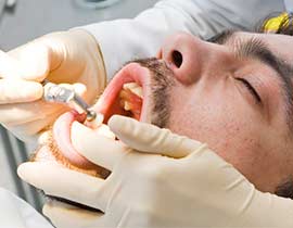 Sedation Dentistry